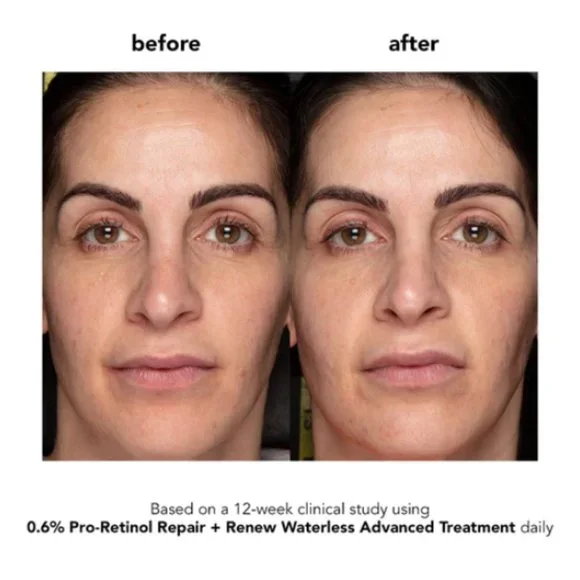 đ„3/$30 NEW Boscia 0.6% Pro-Retinol Repair + Renew Treatment Full Size $48.00 - Picture 14 of 14